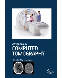 Advances in Computed Tomography